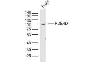 Mouse brain lysates probed with PDE4D Polyclonal Antibody, unconjugated  at 1:300 overnight at 4°C followed by a conjugated secondary antibody at 1:10000 for 90 minutes at 37°C. (PDE4D anticorps  (AA 401-550))