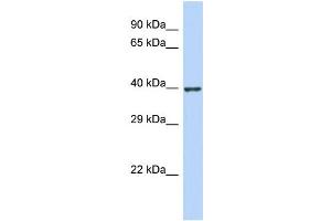 Host:  Rabbit  Target Name:  ZNF607  Sample Type:  Jurkat Whole Cell lysates  Antibody Dilution:  1. (ZNF607 anticorps  (N-Term))