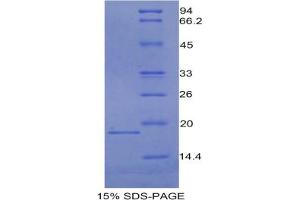SDS-PAGE analysis of Mouse CEA Protein. (CEA Protéine)