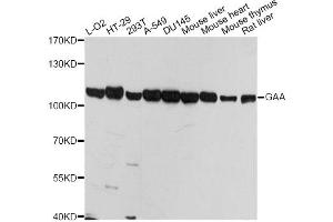 Western blot analysis of extracts of various cell lines, using GAA antibody (ABIN5974462) at 1/1000 dilution. (GAA anticorps)