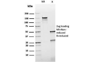SDS-PAGE Analysis Purified HSP60 Mouse Recombinant Monoclonal Antibody (rGROEL/780).