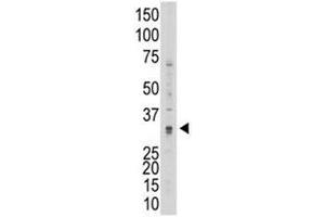 Western blot testing of MMP7 antibody and 293 cell lysate