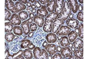 IHC-P Image PCCB antibody [N2C3] detects PCCB protein at mitochondria on mouse kidney by immunohistochemical analysis.