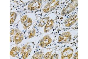 Immunohistochemistry of paraffin-embedded Human stomach using SERPINB5 Polyclonal Antibody at dilution of 1:200 (40x lens).