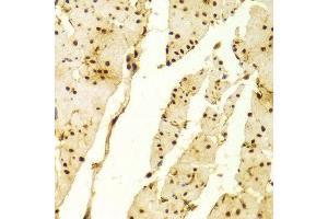 Immunohistochemistry of paraffin-embedded Human esophageal using MSH2 antibody at dilution of 1:100 (x400 lens).
