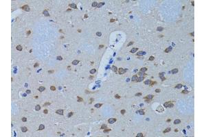 Immunohistochemistry of paraffin-embedded rat brain using PLCB1 antibody (ABIN3022698, ABIN3022699, ABIN3022700, ABIN1513385 and ABIN6219126) at dilution of 1:100 (40x lens). (Phospholipase C beta 1 anticorps  (AA 917-1216))