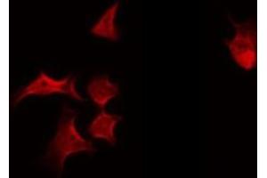 ABIN6269225 staining HeLa by IF/ICC.