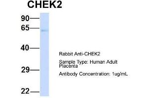 Host:  Rabbit  Target Name:  CHEK2  Sample Type:  Human Adult Placenta  Antibody Dilution:  1. (CHEK2 anticorps  (N-Term))