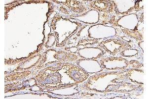 IHC analysis of CALR using anti-CALR antibody (ABIN7600329). (Calreticulin anticorps  (AA 18-323))