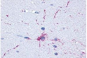 Immunohistochemical (Formalin/PFA-fixed paraffin-embedded sections) staining in human brain, neurons and glia with GRM8 polyclonal antibody . (GRM8 anticorps  (C-Term))