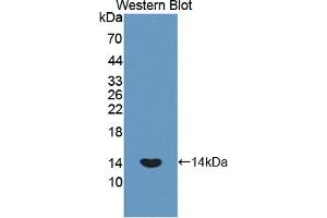 Figure. (PLOD1 anticorps  (AA 636-727))