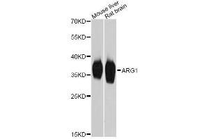 Western blot analysis of extracts of various cell lines, using ARG1 Antibody. (Liver Arginase anticorps  (AA 1-322))