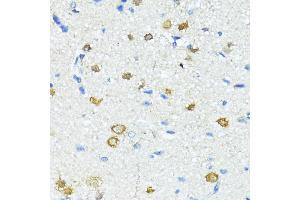 Immunohistochemistry of paraffin-embedded Rat brain using Nestin antibody (ABIN6128335, ABIN6144536, ABIN6144537 and ABIN6215496) at dilution of 100 (40x lens).