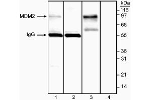 Immunoprecipitation/western blot analysis of MDM2. (MDM2 anticorps  (AA 154-167))