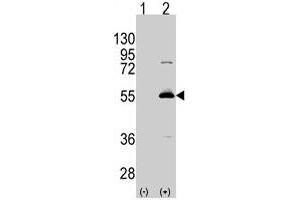 Western blot analysis of ALDH6A1 (arrow) using rabbit ALDH6A1 polyclonal antibody . (ALDH6A1 anticorps  (C-Term))