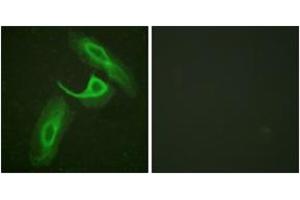 Immunofluorescence analysis of HeLa cells, using CD18/ITGB2 (Ab-758) Antibody. (Integrin beta 2 anticorps  (AA 720-769))