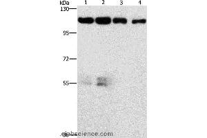 Western blot analysis of Hela and hepG2 cell, lovo cell and human colon cancer tissue, using CDK11A/CDK11B Polyclonal Antibody at dilution of 1:750 (CDK11 anticorps)
