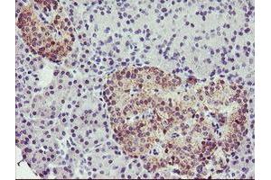 Immunohistochemical staining of paraffin-embedded Human pancreas tissue using anti-TMOD1 mouse monoclonal antibody. (Tropomodulin 1 anticorps)