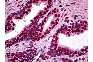 Anti-MEF2A antibody IHC of human prostate. (MEF2A anticorps  (AA 71-170))