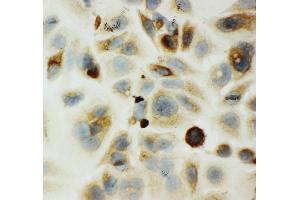 Anti-HYAL1 antibody,  ICC ICC: MCF-7 Cell