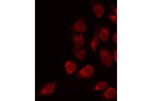 ABIN6275382 staining COLO205 by IF/ICC. (Kcng2 anticorps  (Internal Region))
