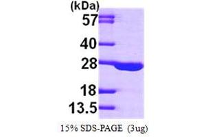 SDS-PAGE (SDS) image for Adenylate Kinase 1 (AK1) (AA 1-194) protein (His tag) (ABIN667254)