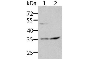 Western Blot analysis of HT-29 and 231 cell using SOCS1 Polyclonal Antibody at dilution of 1:1700 (SOCS1 anticorps)