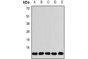 Western blot analysis of FKBP2 expression in MCF7 (A), SKOV3 (B), Jurkat (C), mouse liver (D), mouse brain (E) whole cell lysates. (FKBP2 anticorps)