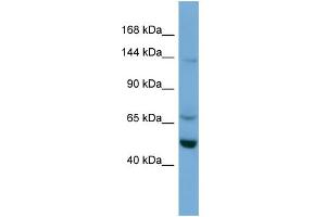 WB Suggested Anti-TRIM66 Antibody Titration:  0. (TRIM66 anticorps  (N-Term))