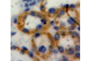 Used in DAB staining on fromalin fixed paraffin-embedded Liver tissue (NOD1 anticorps  (AA 612-826))