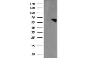 anti-Rhotekin (RTKN) antibody