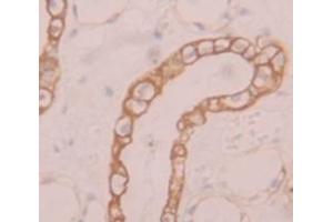 IHC-P analysis of Human Tissue, with DAB staining. (SLC39A6 anticorps  (AA 29-325))