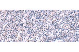 Immunohistochemistry of paraffin-embedded Human tonsil tissue using KCNK10 Polyclonal Antibody at dilution of 1:45(x200) (KCNK10 anticorps)