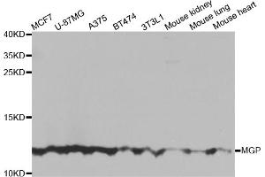 Western blot analysis of extracts of various cell lines, using MGP antibody. (MGP anticorps)
