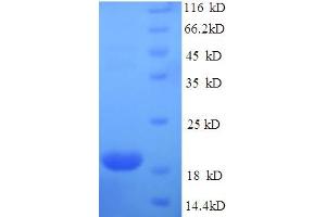 Immunoglobulin-Like Domain Containing Receptor 2 (ILDR2) (AA 1-186), (Extracellular) protein (His tag)