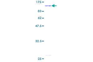 Image no. 1 for Inner Membrane Protein, Mitochondrial (IMMT) (AA 1-758) protein (GST tag) (ABIN1307874)