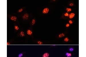 Immunofluorescence analysis of NIH/3T3 cells using TriMethyl-Histone H3-K64 Polyclonal Antibody at dilution of 1:100. (Histone 3 anticorps  (3meLys64))