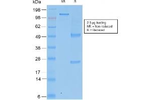 SDS-PAGE Analysis Purified TIMP2 Mouse Recombinant Monoclonal Antibody (rTIMP2/2335). (Recombinant TIMP2 anticorps  (N-Term))