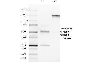 SDS-PAGE Analysis Purified ROR-gamma / RORC Mouse Monoclonal Antibody (RORC/2942). (RORC anticorps)