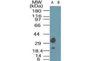 Western blot analysis of LYK5 in A-549 cell lysate in the (A) absence and (B) presence of immunizing peptide using LYK5 polyclonal antibody  at 1 ug/mL . (STRADA anticorps  (AA 300-350))