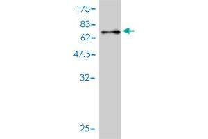 Western Blot detection against Immunogen (71.