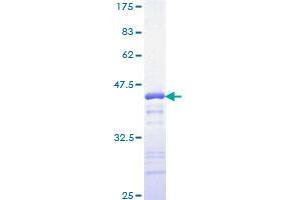 Image no. 1 for YY1 Transcription Factor (YY1) (AA 221-320) protein (GST tag) (ABIN1325560)