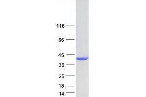 Validation with Western Blot