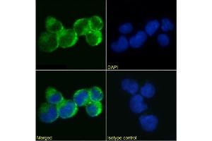 Immunofluorescence staining of Jurkat cells using anti-IL-9R antibody AH9R2.