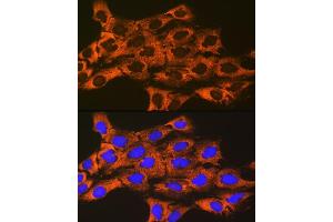 Immunofluorescence analysis of C6 cells using UQCRFS1 Rabbit mAb (ABIN7271127) at dilution of 1:100 (40x lens). (UQCRFS1 anticorps)