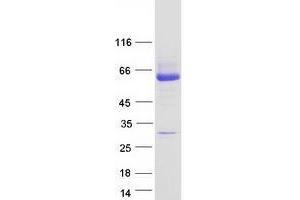 Validation with Western Blot
