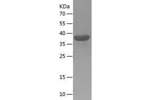Western Blotting (WB) image for Elastin Microfibril Interfacer 1 (EMILIN1) (AA 676-1016) protein (His tag) (ABIN7122755)