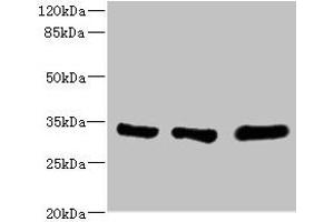Western blot All lanes: EIF2B1 antibody at 5.