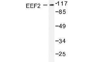 Image no. 1 for anti-Eukaryotic Translation Elongation Factor 2 (EEF2) antibody (ABIN265392) (EEF2 anticorps)