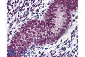 ABIN335135 (3. (EWSR1 anticorps  (Internal Region))